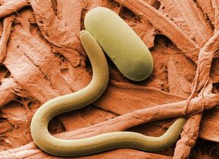 Soybean cyst nematode